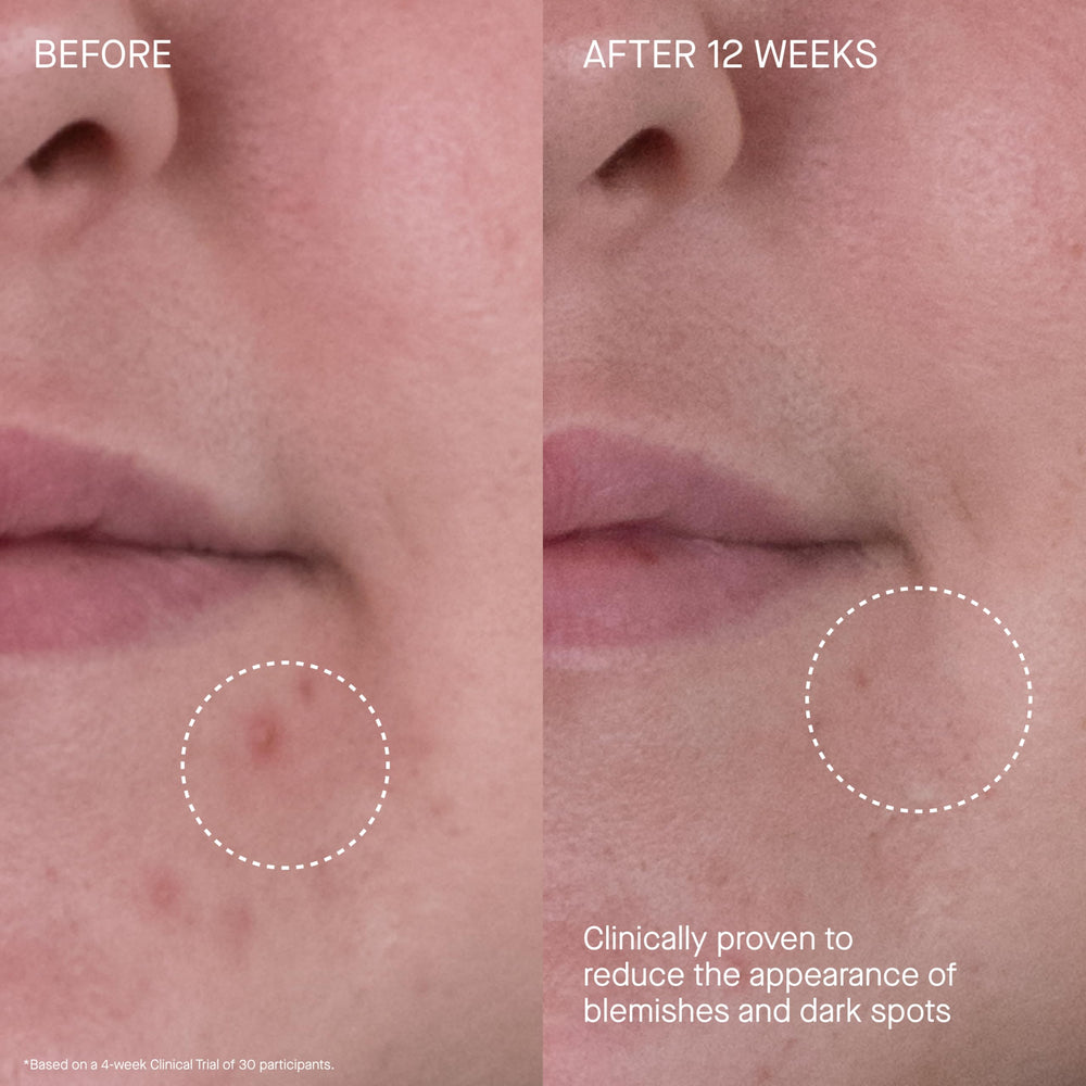 Augustinus Bader Rich Cream close-up emphasizes gentle wrinkle-smoothing for mature skin.