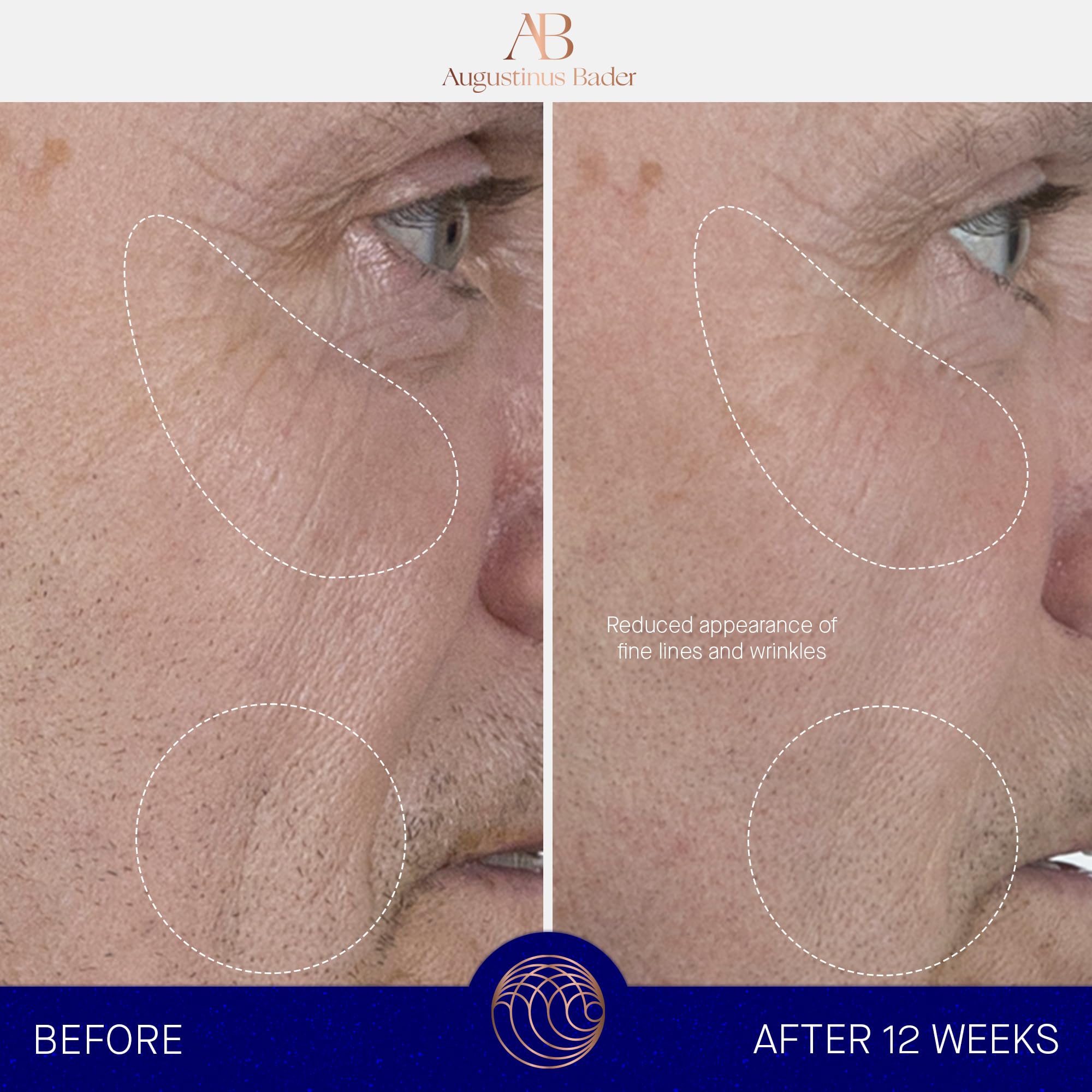 Augustinus Bader The Serum texture swatch reveals silky, fast absorbing hydration for daily use