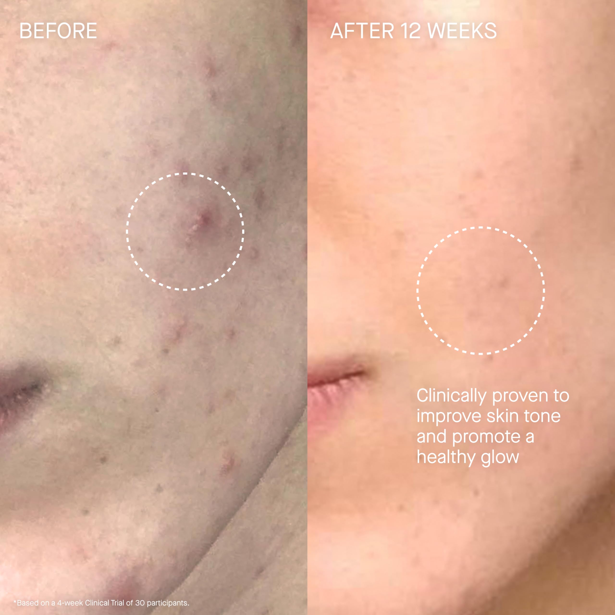 Augustinus Bader The Cream on neck and decollete delivers smooth, hydrated skin.