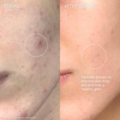 Augustinus Bader The Cream on neck and decollete delivers smooth, hydrated skin.
