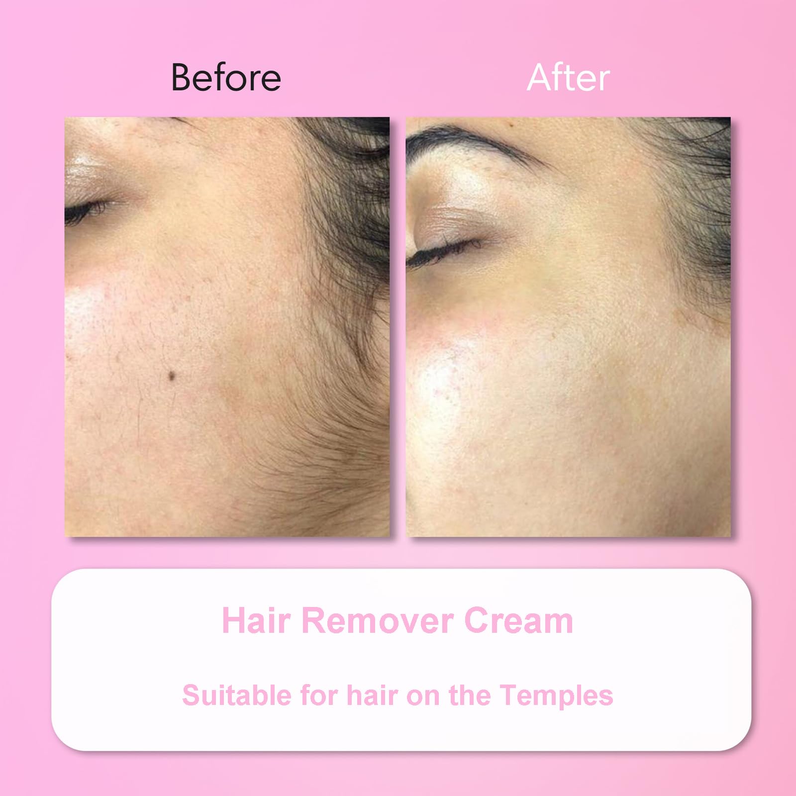 Aurlux Hair Remover Cream suitable for both men and women.