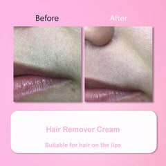 Aurlux Hair Remover Cream sideburns removal supports precise facial grooming.