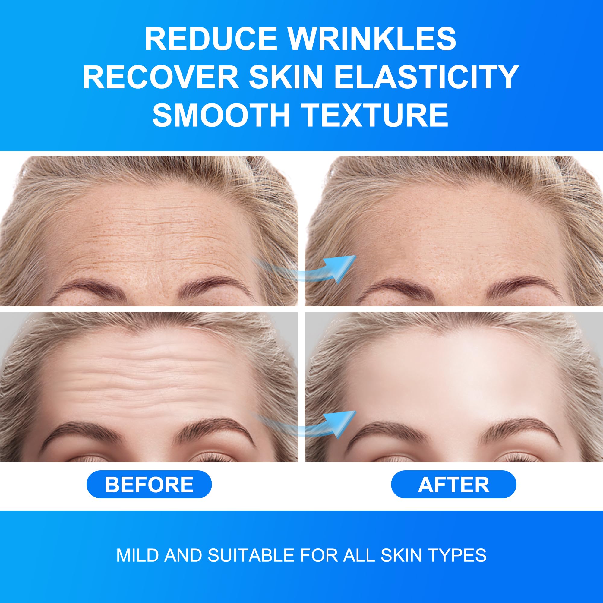 Auteek 20 count pack of forehead wrinkle patches for regular use