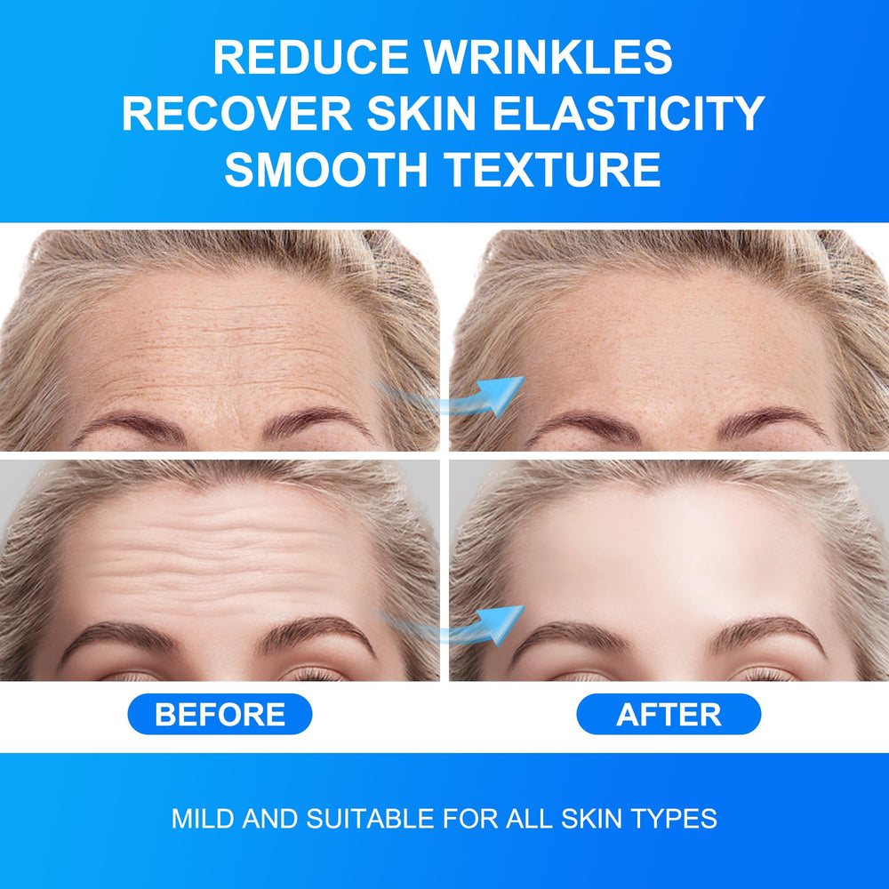Auteek 20 count pack of forehead wrinkle patches for regular use