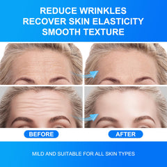 Auteek 20 count pack of forehead wrinkle patches for regular use