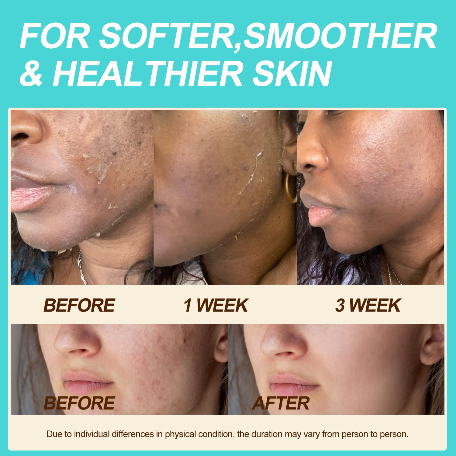 Auteli balm texture appears light and fast-absorbing on skin.