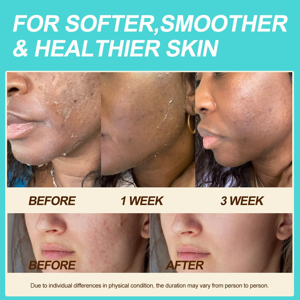 Auteli balm texture appears light and fast-absorbing on skin.