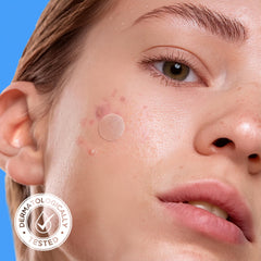 AVARELLE bulk pack 10-14mm patches for easy reapplication across a routine.