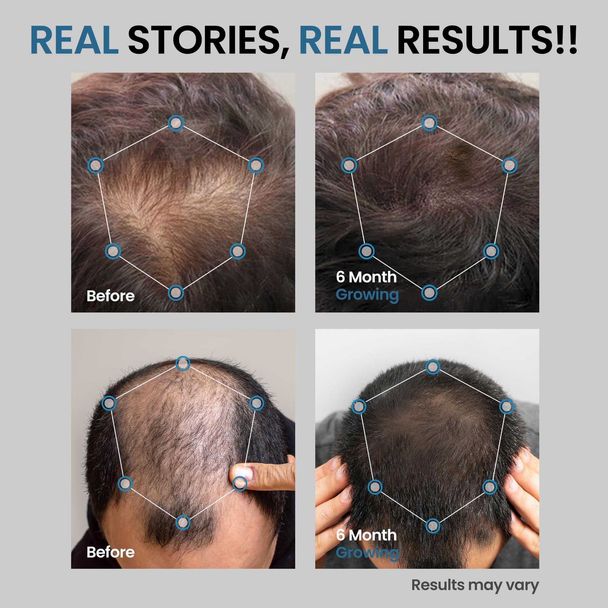 AVITAPURE ingredient panel with Biotin and Rosemary Oil