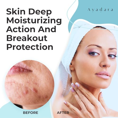 AYADARA oil-prone skin showcase highlights suitability for daily acne care.