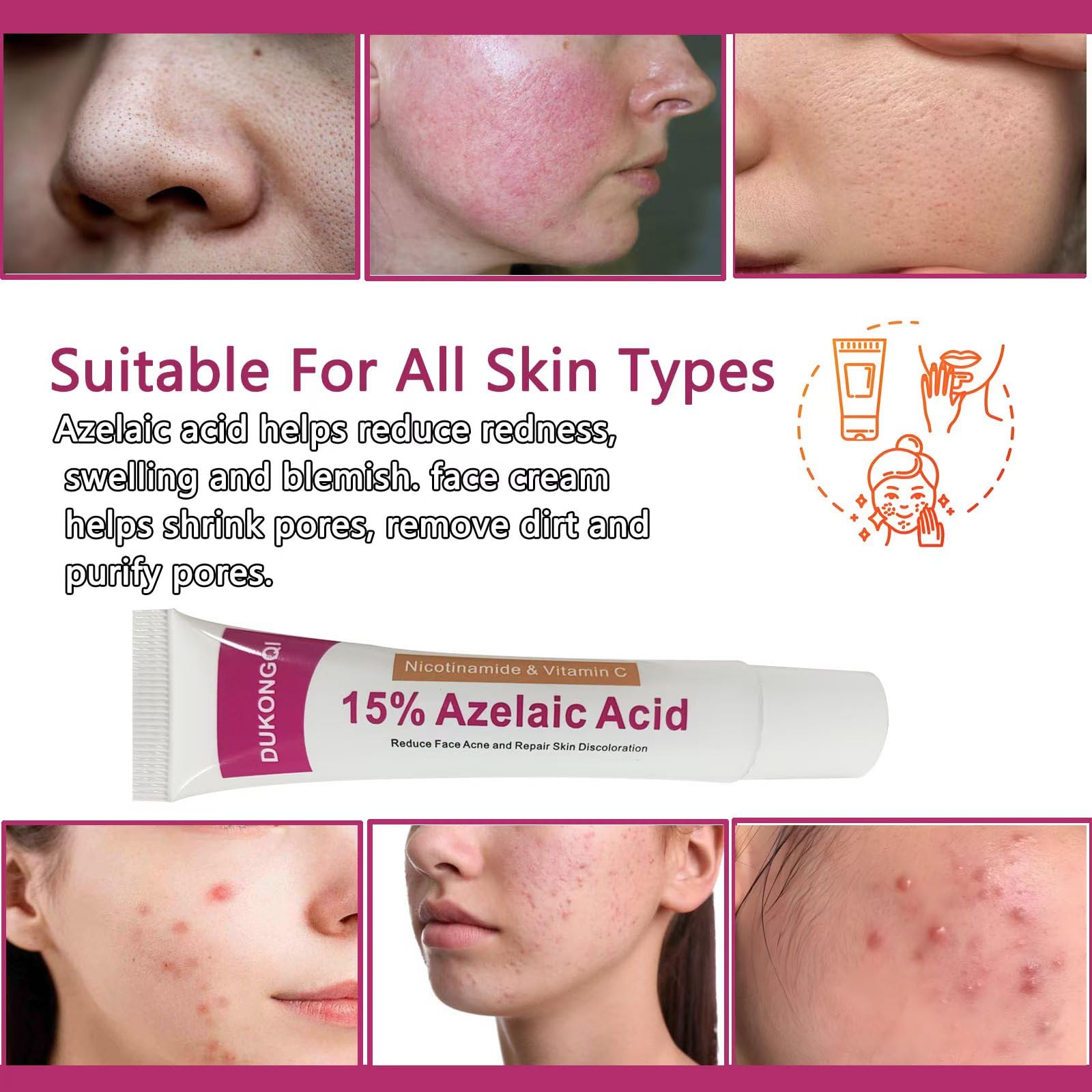 Azelaic acid serum bottle with minimalist packaging for premium skincare.