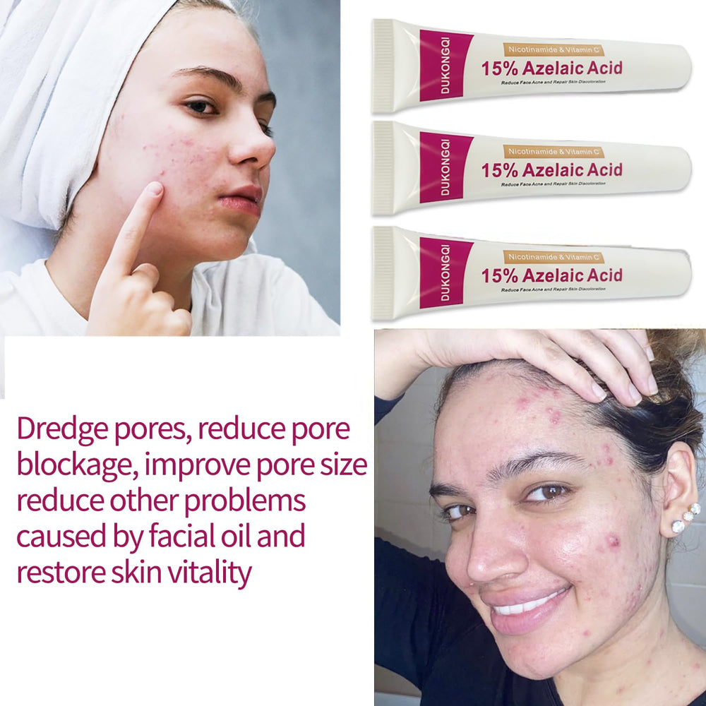 Azelaic Acid Serum texture close-up highlights smooth consistency.