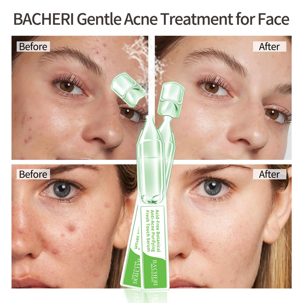 BACHERI daily ampoules pack highlights convenient 1.2 ml doses for fresh, mess-free application.