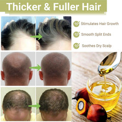 BALPPRD Lifewitqueenp suitable for all hair types in daily care.