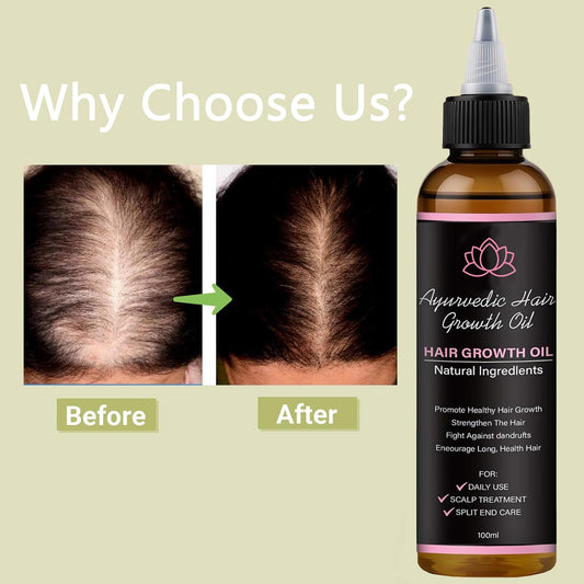 BALPPRD Lifewitqueenp scalp balance during oil application for nourishment.