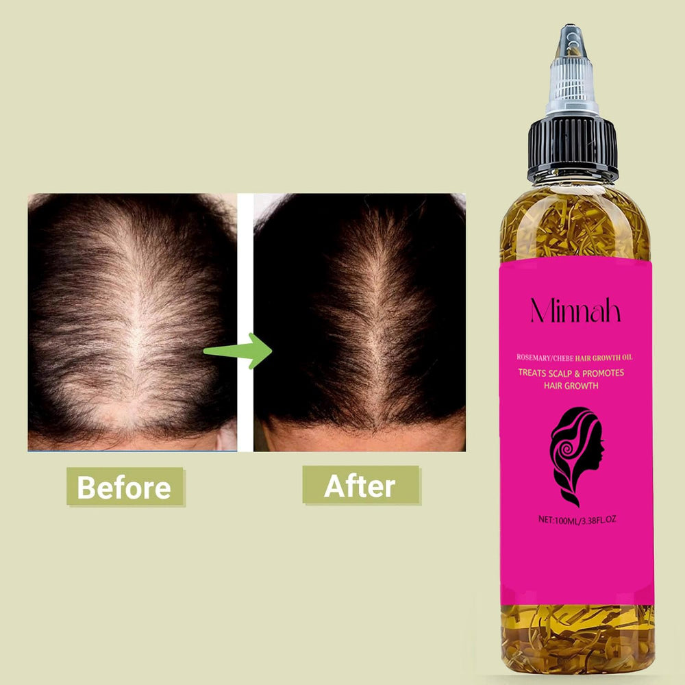 BALPPRD Minnah Batana Oil being applied for scalp massage and absorption.