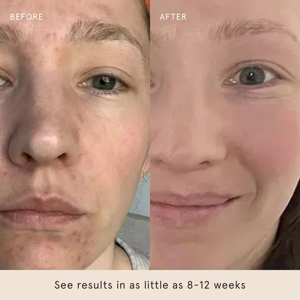Barefaced Glow Peel Pads compact pack in a bag for travel.