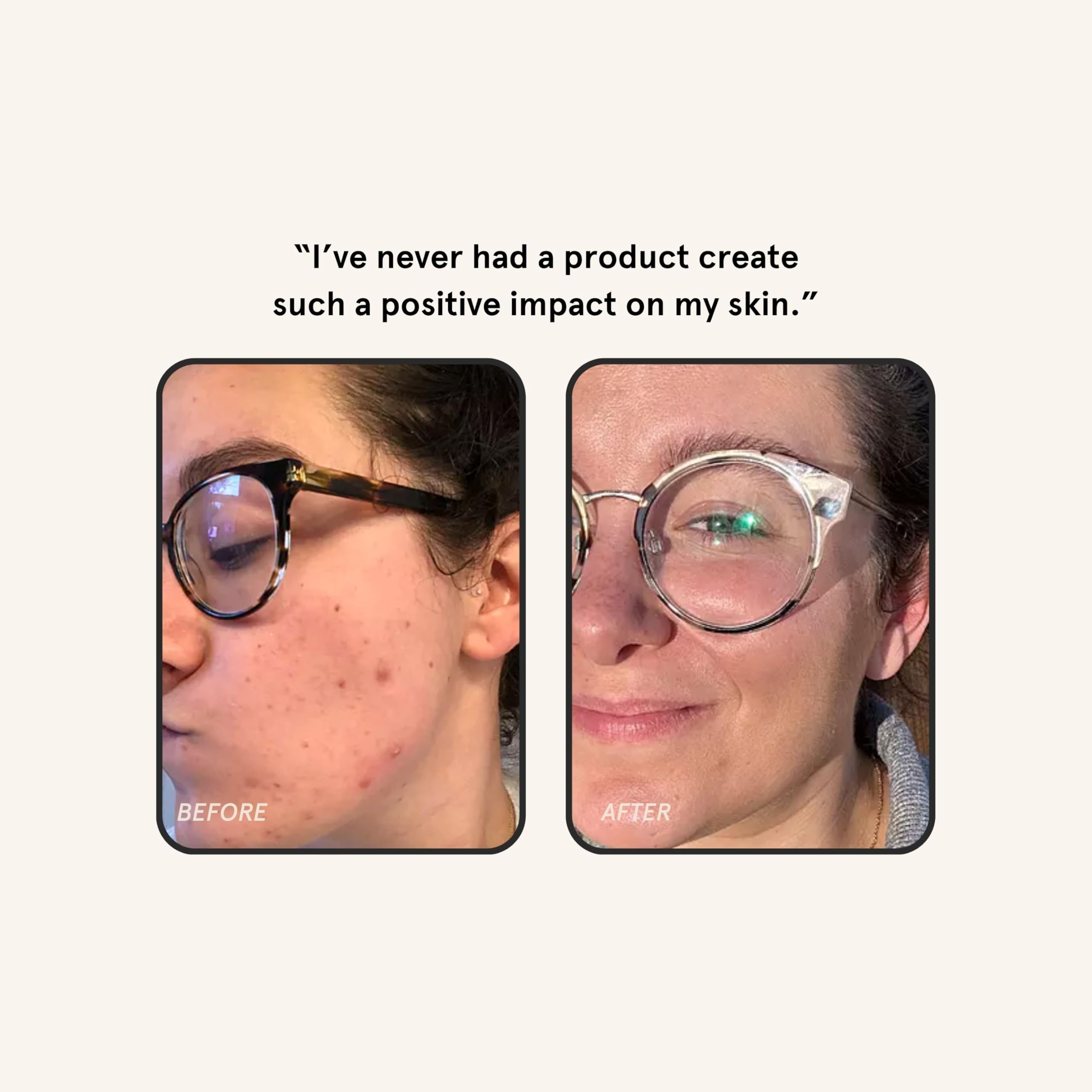 Application to neck and chest with Barefaced Overachiever for balanced skin.