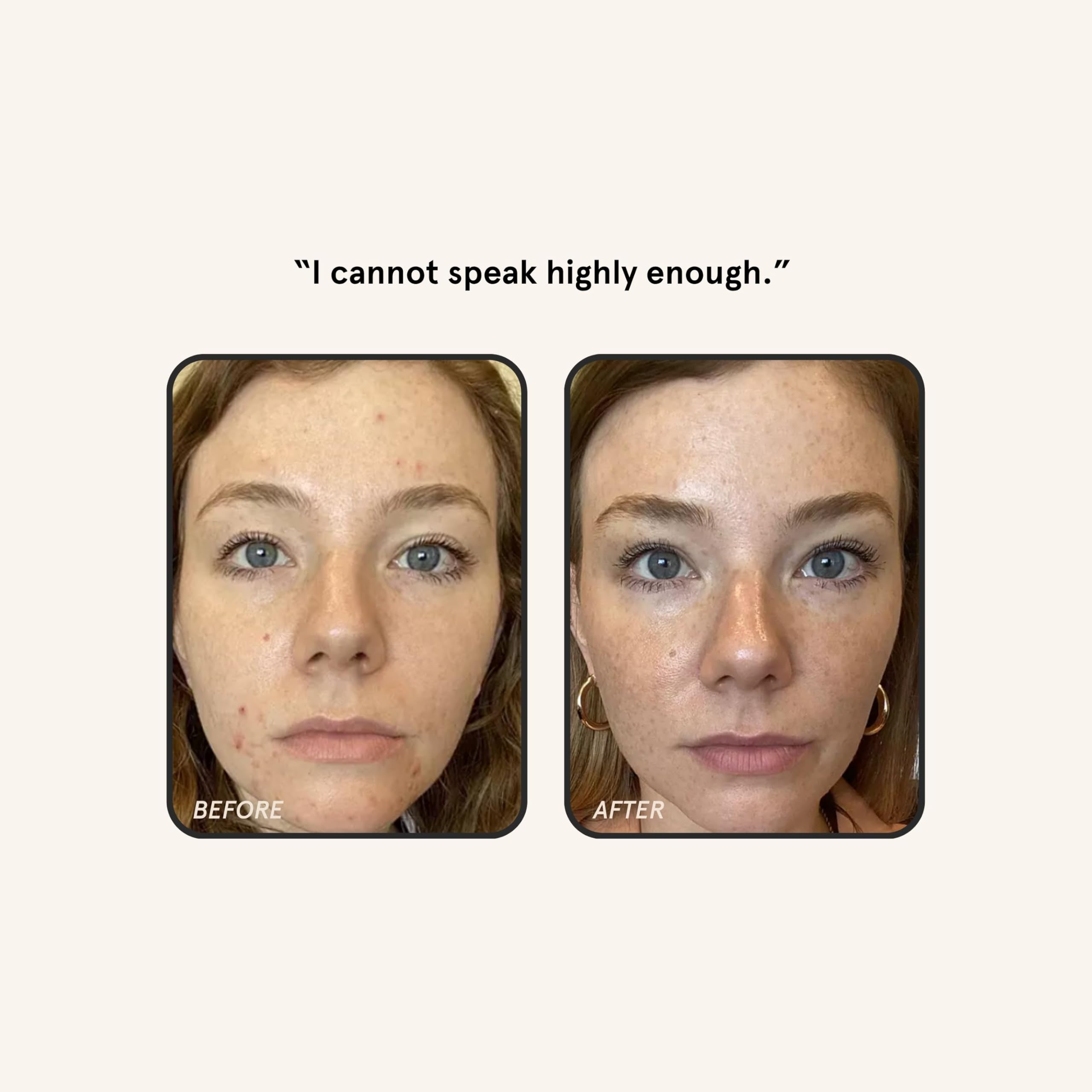 Barefaced Retinal Skin Therapy label close-up highlighting key ingredients