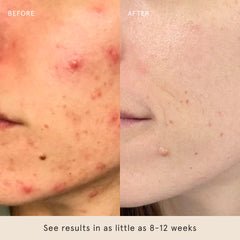 Barefaced Toning Pads II serums-ready skin preparation closeup