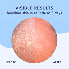 Barefoot Scientist High Dive texture closeup highlighting creamy hydration for cracked heels
