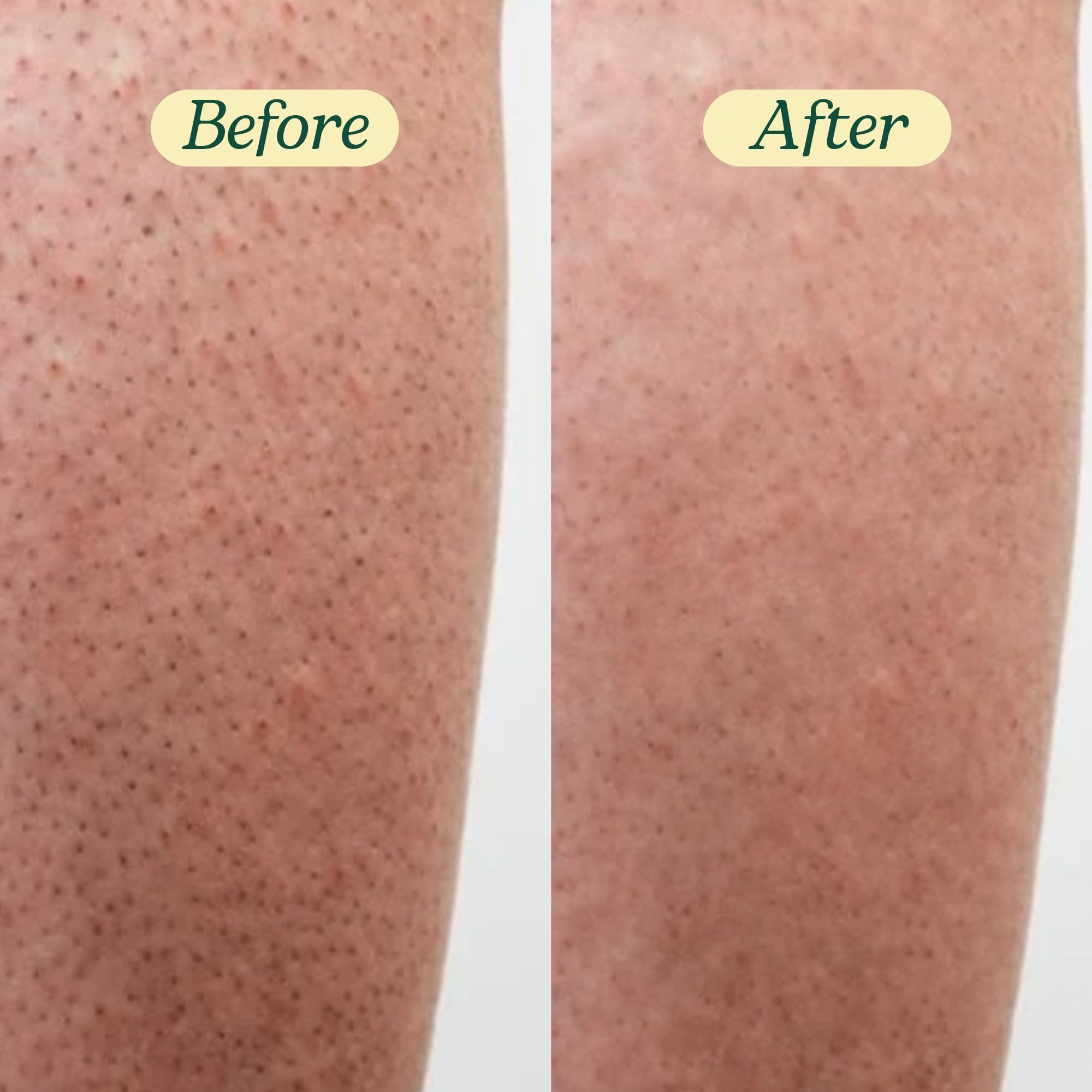 BareSoul FREE scrub scalp massage image illustrates refreshing cleansing moment.