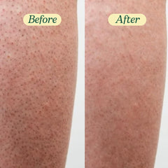 BareSoul FREE scrub scalp massage image illustrates refreshing cleansing moment.
