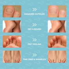 Bayside Foot Mask Moisturizing Socks on feet delivers quick hydration.