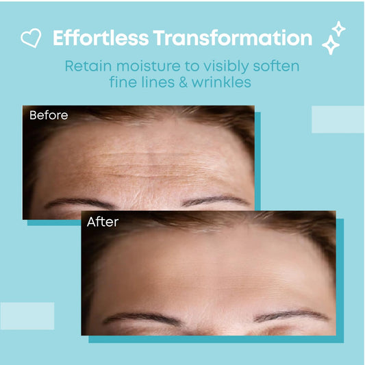 Bayside forehead patches applied on forehead for discreet wear.