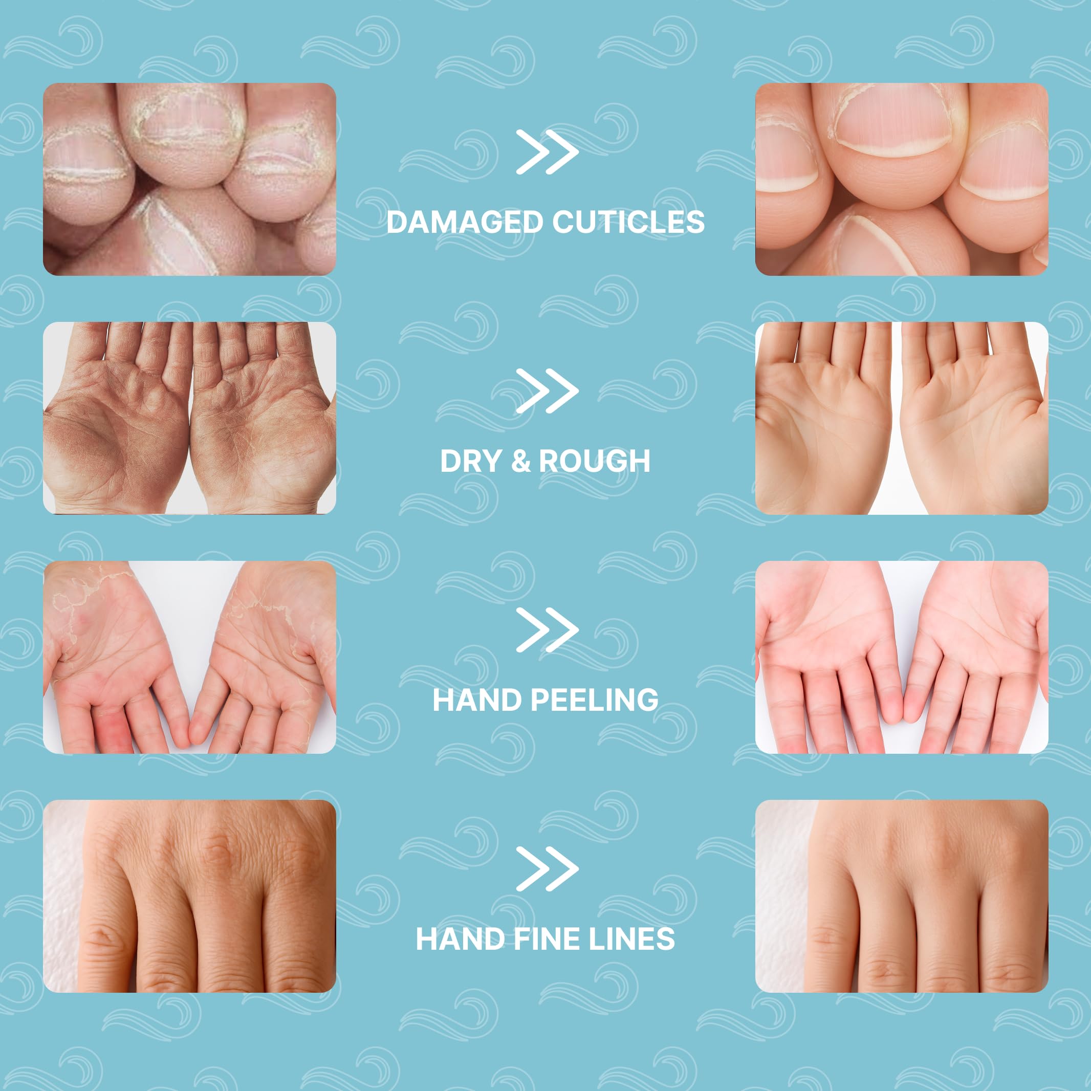 Bayside Snail Mucin and Shea Butter nourish dry skin in glove form.