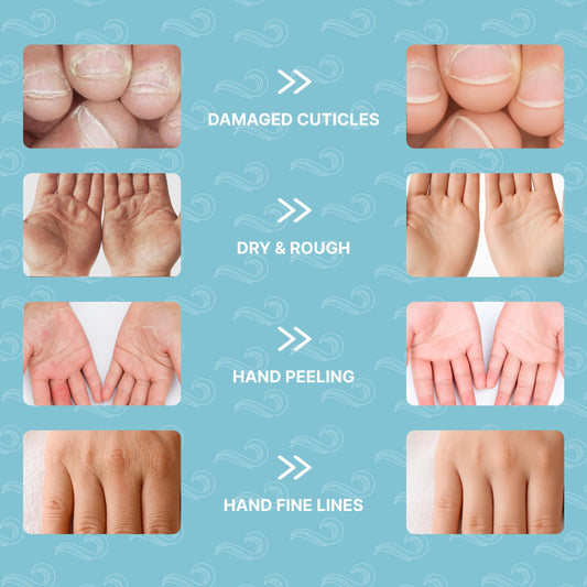Bayside Snail Mucin and Shea Butter nourish dry skin in glove form.