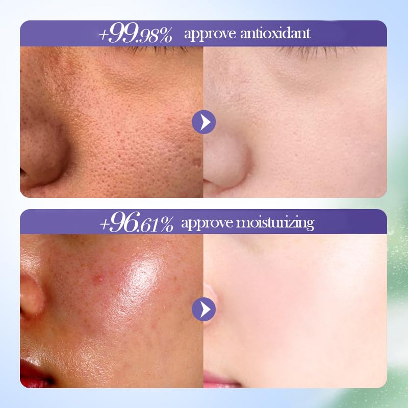 BeauBase Blueberry Eye Cream designed to nourish the delicate eye area.