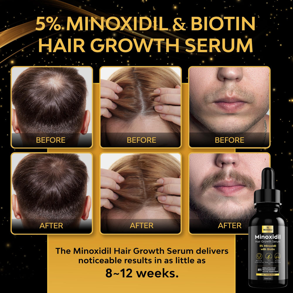 Beaueli hair growth results highlighting fuller-looking strands over time.