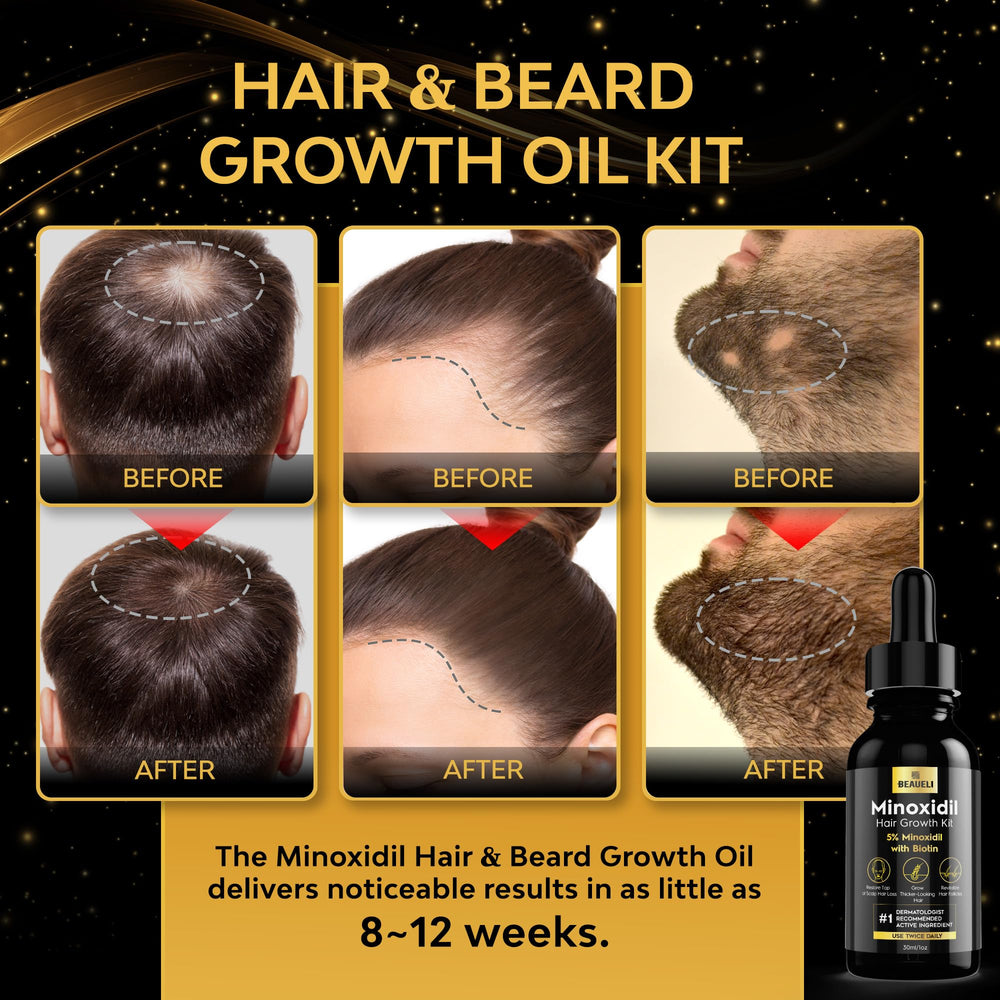 Beaueli Minoxidil beard kit box showing full kit for at-home use