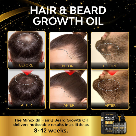 Beaueli Minoxidil serum absorption on the scalp for quick uptake