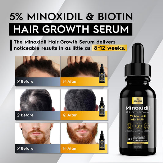 Beaueli Minoxidil dropper enables precise scalp application