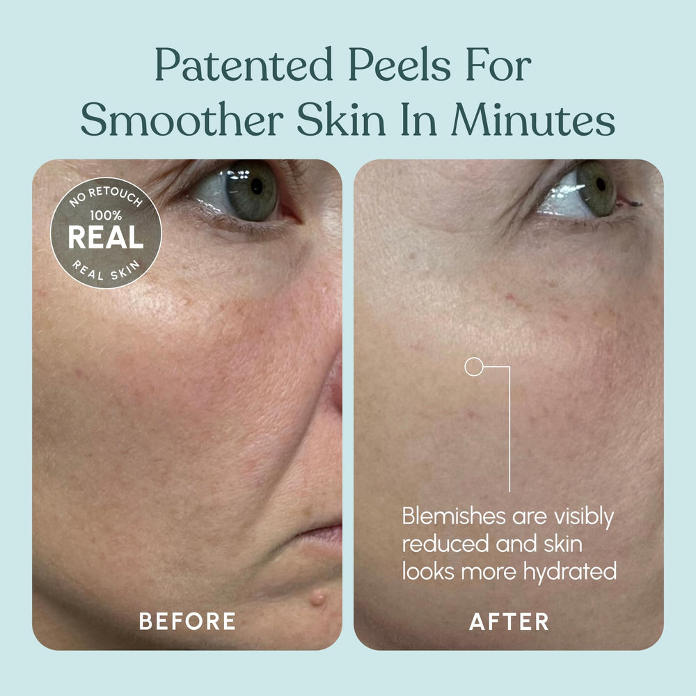 Beautiste Patch Test guidance on skin before full use