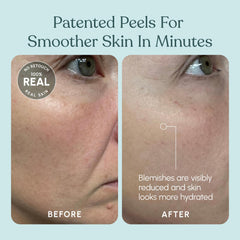 Beautiste Patch Test guidance on skin before full use