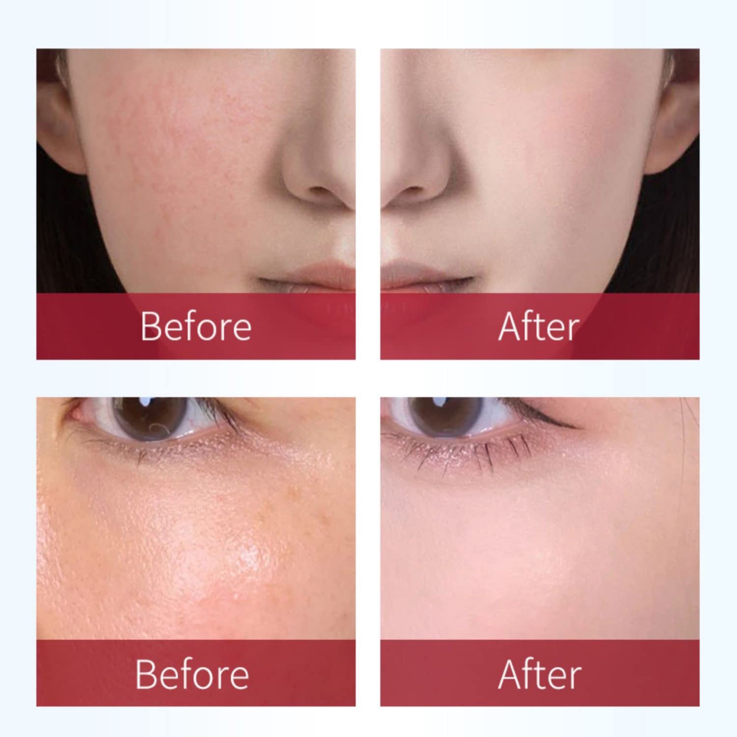 Beauty-Mall Rosaderm Fast Gel Cream lightweight primer texture for daily wear.