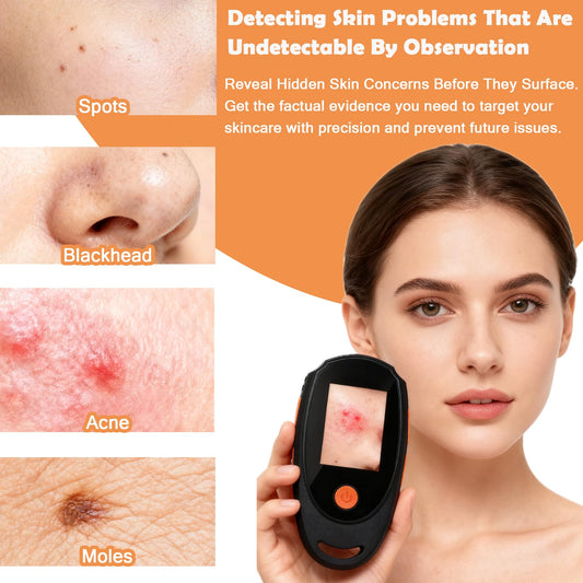 Beauty Star skin camera captures photos and videos for on-device records