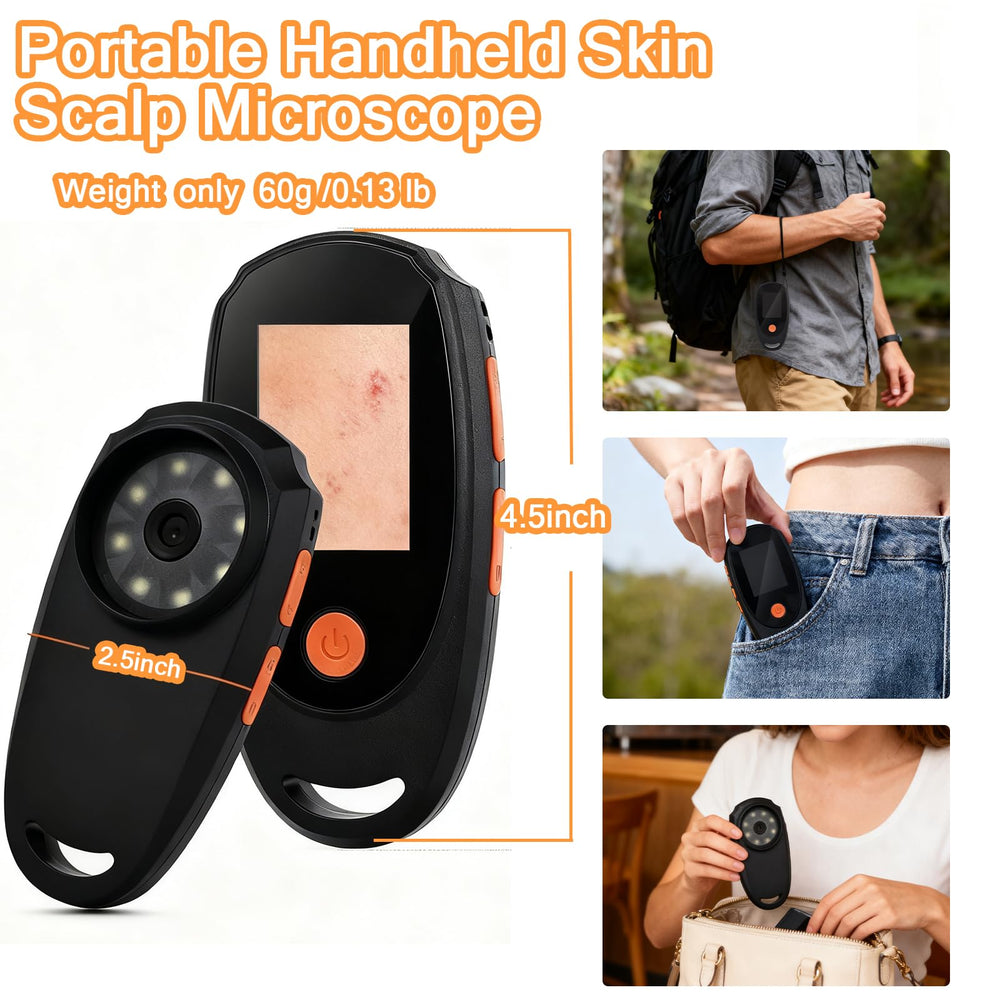 Beauty Star dermatoscope supports TF card expansion up to 64GB for more storage