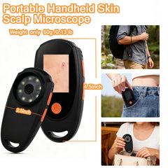 Beauty Star dermatoscope supports TF card expansion up to 64GB for more storage