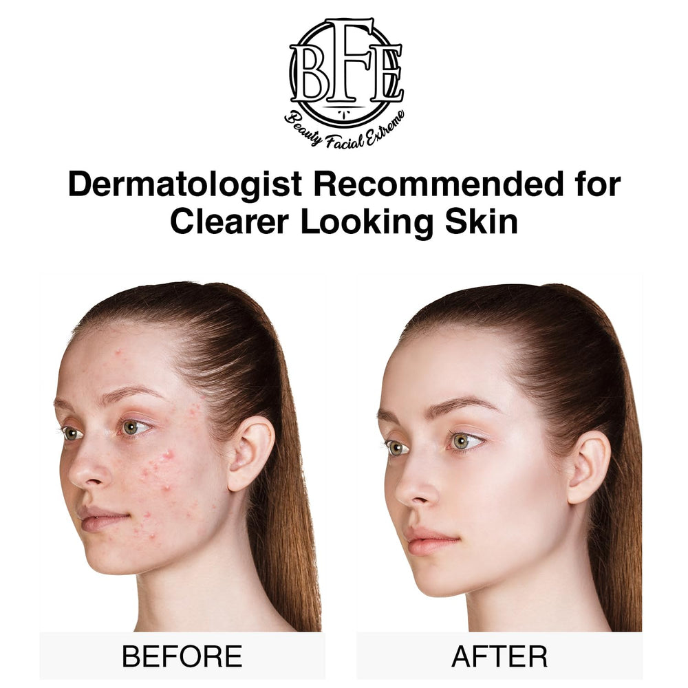 Beauty Facial Extreme Acne Pad texture shows micro exfoliating action.