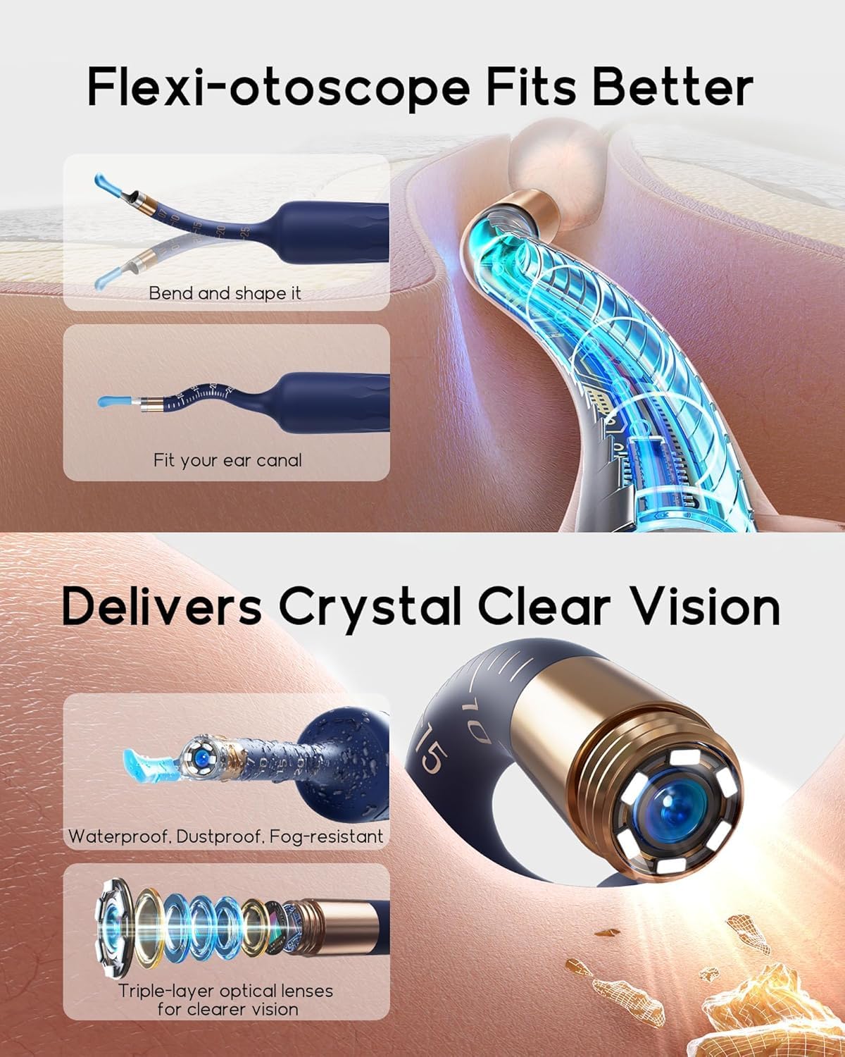BEBIRD Earsight Plus D39R painless ear tweezers target debris safely and gently