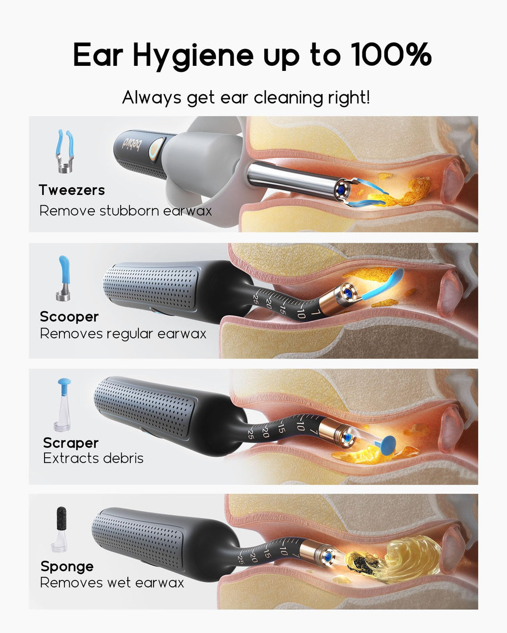BEBIRD high-resolution display aids precise wax removal decisions.