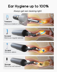 BEBIRD high-resolution display aids precise wax removal decisions.