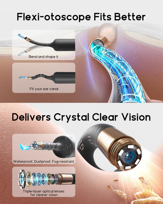 BEBIRD soft silicone tip for gentle, comfortable ear cleaning.