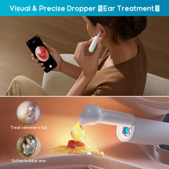 BEBIRD Home 30S wax removal tweezers remove debris safely