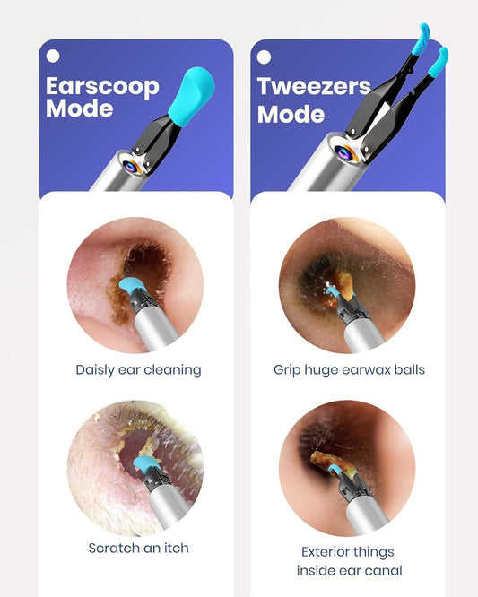 BEBIRD Note5 tweezers close-up enabling gentle, precise wax extraction.