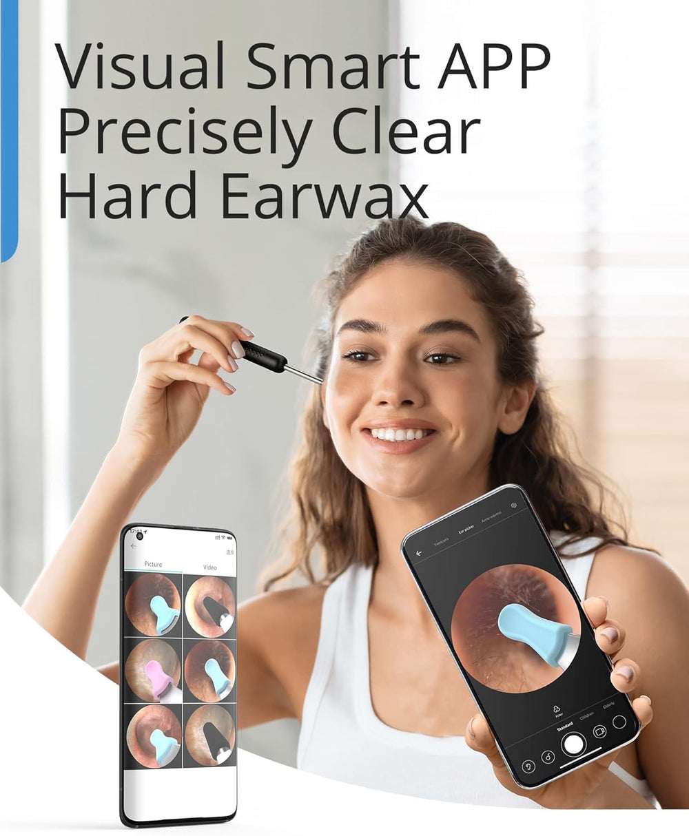 BEBIRD R1 nose speculum kit enables multi-use checks.